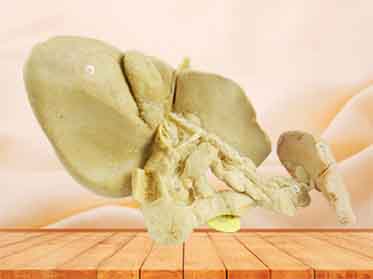 Pancreas spleen and duodenum in vitro plastinated specimen