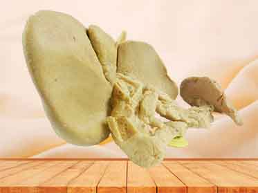 Pancreas spleen and duodenum in vitro plastination