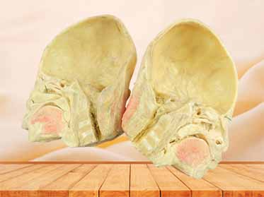 Paranasal sinuses and its opening