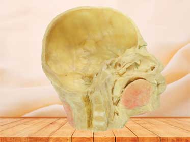 Paranasal sinuses and its opening plastination