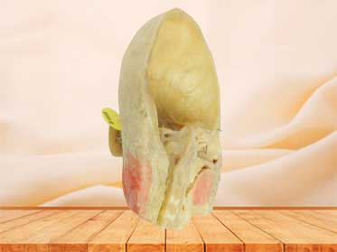 Paranasal sinuses and its opening specimen