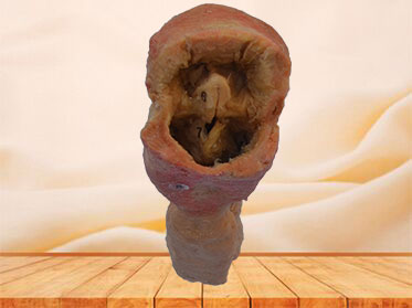 Pharynx and larynx