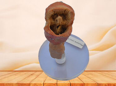 Pharynx and larynx plastinated specimen
