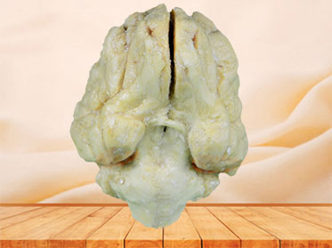 Pig brain plastination