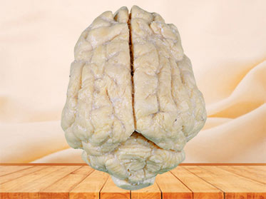 Pig brain plastination specimen