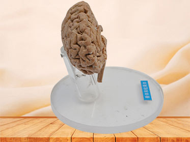 Pituitary and pineal gland plastinated specimen