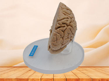 Pituitary and pineal gland plastination specimen
