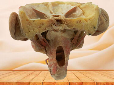 Posterior of pharyngeal muscles