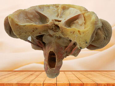 Posterior of pharyngeal muscles anatomy specimen