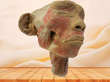 Posterior of pharyngeal muscles plastinated specimen