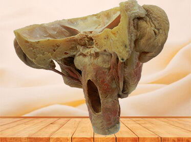 Posterior of pharyngeal muscles plastination specimen