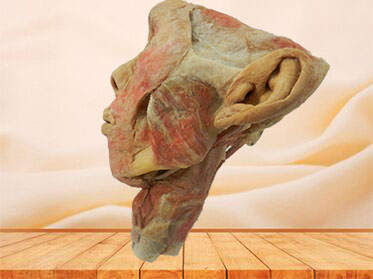 Posterior of pharyngeal muscles specimen