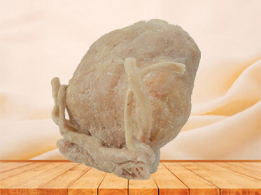 Prostate seminal vescle, bladder anatomic specimen