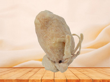 Prostate seminal vescle, bladder human plastination for sale