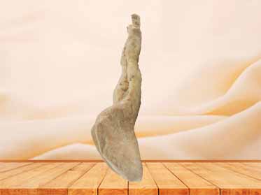 Rectum and anal canal plastinated specimen