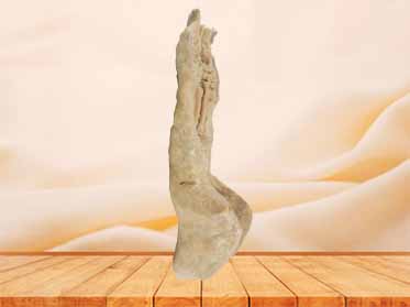 Rectum and anal canal plastination