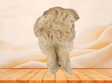 Rectum and anal canal teaching specimen