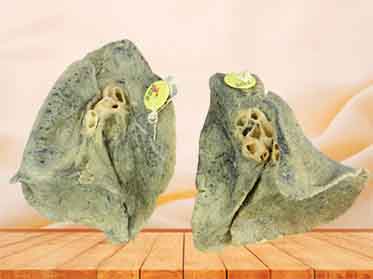 Root of the lung medical plastination