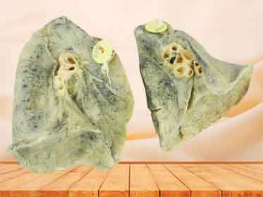 Root of the lung specimen for sale