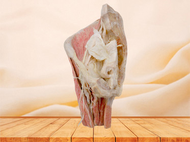 Sagittal section of Female pelvis anatomic specimen
