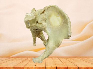 Sagittal section of female pelvis plastinated specimen