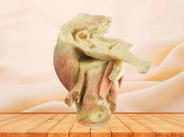 Sagittal section of male pelvic plastinized cadavers