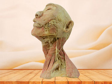 Superficial vascular nerve of head and neck plastinated specimen