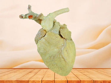 The anatomy of sheep cardiovascular plastination specimen