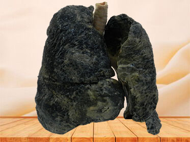 The lung of smoker