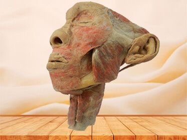 The plastination of Posterior of pharyngeal muscles