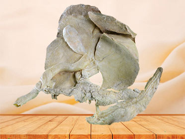 The plastination specimen of pig liver pancreas , duodenum , spleen