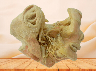 Trigeminal nerve