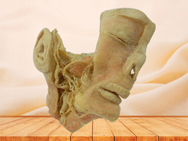 Trigeminal nerve