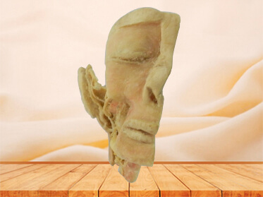 Trigeminal nerve