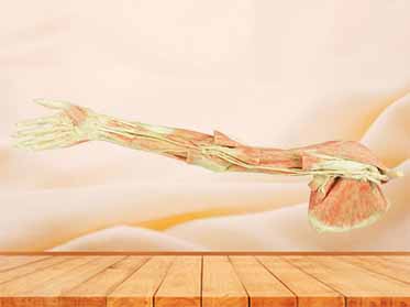 Upper limb arteries medical specimen