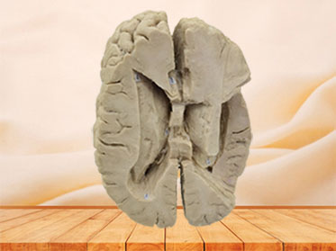 Ventricle and the insula plastinated specimen