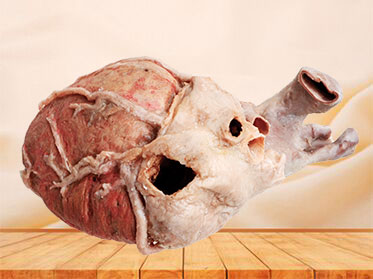 Whole heart anatomy specimen