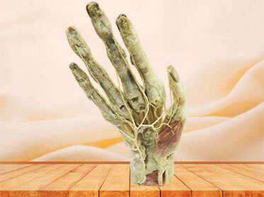 arcus volaris profundus plastination specimen