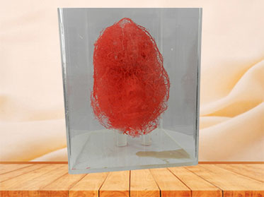 artery of head and neck casting specimen