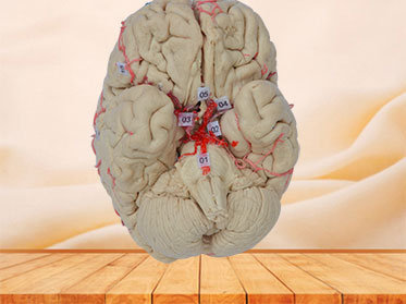 artery of whole brain plastinated specimen