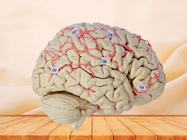 artery of whole brain plastination