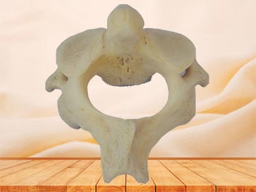 Axis plastinated specimen