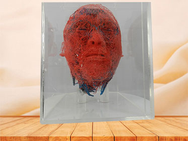 blood vessels of head and neck casting specimen