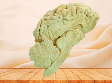 brain hemisphere of sheep specimen plastination