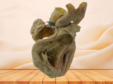cardiac conduction system