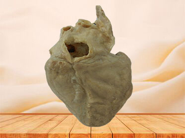 cardiac conduction system anatomy specimen