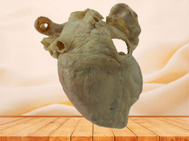 cardiac conduction system human specimen