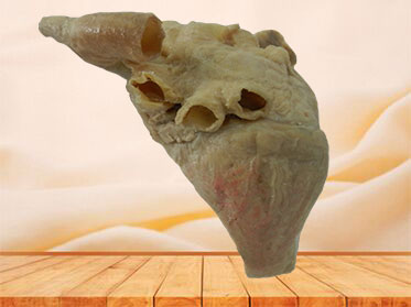 cardiac conduction system plastination specimen