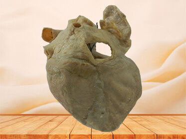 cardiac conduction system specimen