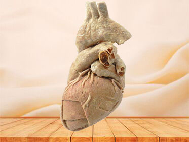 cardiac muscle human specimen